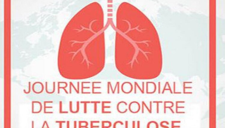 Webinaire SEE – journée mondiale de lutte contre la tuberculose :  Quelles solutions pour mettre fin à la tuberculose ?